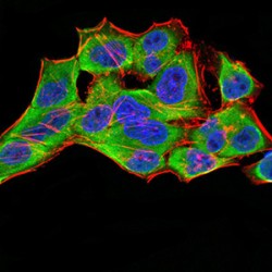 14-3-3 Protein Beta/Alpha (YWHAB) Antibody