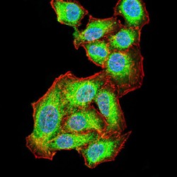 RAC-Alpha Serine/threonine-Protein Kinase (AKT1) Antibody