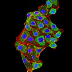 Lysine-Specific Histone Demethylase 1A (KDM1A) Antibody