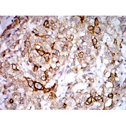 Membrane-Associated Progesterone Receptor Component 1 (PGRMC1) Antibody