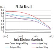 Fig. 1. Figure 1:Black line: Control Antigen (100 ng)Purple line: Antigen (10ng); Blue line: Antigen (50 ng); Red line:Antigen (100 ng)