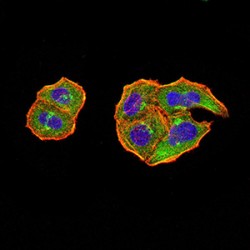 Tyrosine-Protein Phosphatase Non-Receptor Type 14 (PTPN14) Antibody