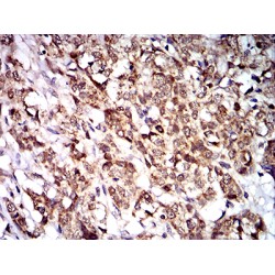 Tyrosine-Protein Phosphatase Non-Receptor Type 14 (PTPN14) Antibody