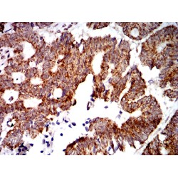 Tyrosine-Protein Phosphatase Non-Receptor Type 14 (PTPN14) Antibody