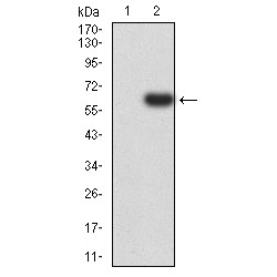 Tyrosine-Protein Phosphatase Non-Receptor Type 14 (PTPN14) Antibody