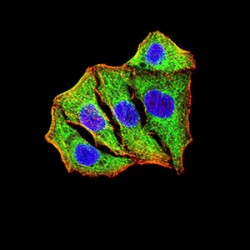 Superoxide Dismutase 2 (SOD2) Antibody