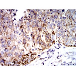 Superoxide Dismutase 2 (SOD2) Antibody