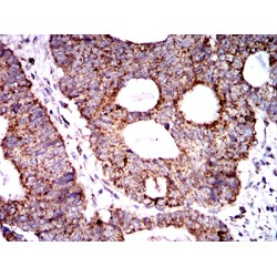 Superoxide Dismutase 2 (SOD2) Antibody