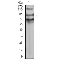 Actin Filament-Associated Protein 1-Like 2 (AFAP1L2) Antibody