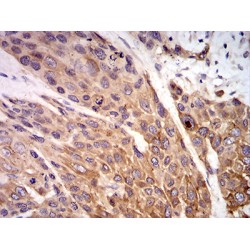 P2X Purinoceptor 7 (P2RX7) Antibody