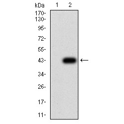 Keratin 10 (KRT10) Antibody