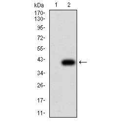 Thrombospondin 1 (THBS1) Antibody