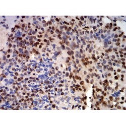 Cold-Inducible RNA-Binding Protein (CIRBP) Antibody