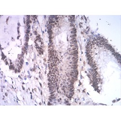 Set1/Ash2 Histone Methyltransferase Complex Subunit ASH2 (ASH2L) Antibody