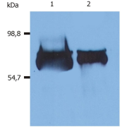 WB analysis of Human blood plasma (1) and Human blood serum (2) using ALB antibody.