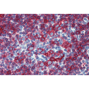 Immunohistochemistry staining of human small intestine (paraffin-embedded sections) with anti-HLA-DR+DP (HL-38).