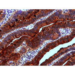 Blood Group Lewis a Antibody