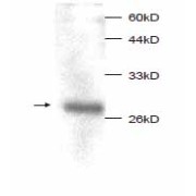 Macrophage Migration Inhibitory Factor (MIF) Antibody