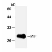 Macrophage Migration Inhibitory Factor (MIF) Antibody