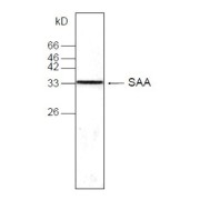 WB analysis of SAA1 expression in human breast carcinoma MCF-7 whole cell lysates, using SAA1 antibody (1/500 dilution).