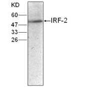 WB analysis of Jurkat whole cell lysates, using IRF2 antibody (1/250 dilution).