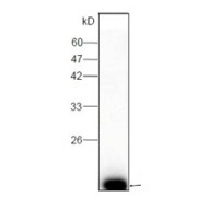 WB analysis of recombinant DENV2 Envelope Protein, using DENV 2 E Antibody (1/1000 dilution).