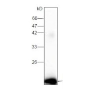 WB analysis of recombinant DENV2 Envelope Protein, using DENV 2 E Antibody (1/1000 dilution).