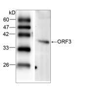 WB analysis of recombinant Hepatitis E virus ORF 3, using HEV ORF3 antibody (1/1000 dilution).