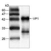 WB analysis of recombinant HAV VP1 Protein, using HAV VP1 antibody (1/1000 dilution).