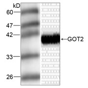 Western Blot analysis of HepG2 whole cell lysate using GOT2 Antibody (1/1000 dilution).