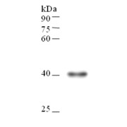 Western blot analysis of transgenic rice, using Hygromycin Phosphotransferase (HPT) Antibody (1/1000 dilution).