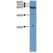 WB analysis of OsMPK4 expression in rice (CV. 9311) flag leaf at the flowering stage, using OsMPK4 Antibody (1/1000 dilution).