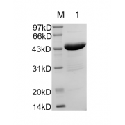 12% SDS-PAGE analysis of recombinant Human SOD1 Protein.