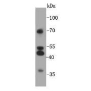 WB analysis of 293 cells.