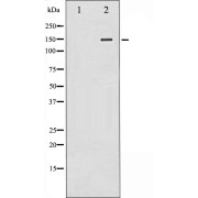 Western blot analysis of PLCG2 expression in COLO205 whole cell lysates, The lane on the left is treated with the antigen-specific peptide.