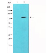 Western blot analysis of HepG2 cell lysate using MMP9 Antibody.