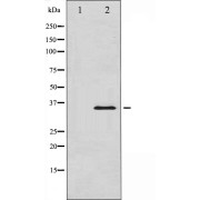 Western blot analysis of IkappaB-alpha expression in TNF-α treated MCF7 whole cell lysates, The lane on the left is treated with the antigen-specific peptide.