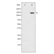 Western blot analysis of Calcium Sensing Receptor expression in LOVO whole cell lysates, The lane on the left is treated with the antigen-specific peptide.