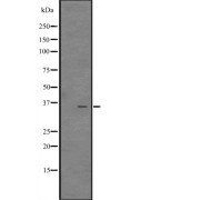 Western blot analysis of CITED4 expression in MCF7 Cell Lysate. The lane on the left is treated with the antigen-specific peptide.