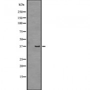 Western blot analysis of GPR43 expression in Human fetal liver lysate. The lane on the left is treated with the antigen-specific peptide.