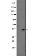 Western blot analysis of GPR141 expression in 721_B whole cell lysate. The lane on the left is treated with the antigen-specific peptide.