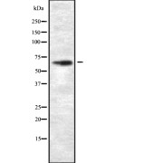 Western blot analysis of GCVK_HHV6U using A549 whole cell lysates.