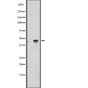 Western blot analysis of ALKBH5 expression in 293 cell line lysate. The lane on the left is treated with the antigen-specific peptide.