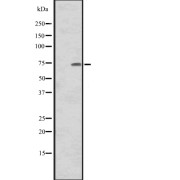 Western blot analysis of CNNM1 expression in Human tonsil tissue lysate, The lane on the left is treated with the antigen-specific peptide.