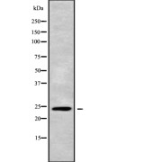 Western blot analysis of APOBEC3H using A549 whole cell lysates.