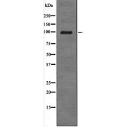 Western blot analysis of UV treated COS7 whole cell lysates.