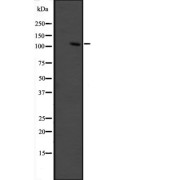 Western blot analysis of GRIP1 expression in fetal muscle lysate. The lane on the left is treated with the antigen-specific peptide.