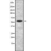 Western blot analysis of SMARCD1/3 using HepG2 whole cell lysates.