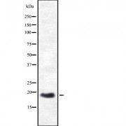 Western blot analysis of HES3 expression in HEK293 cells. The lane on the left is treated with the antigen-specific peptide.