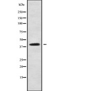 Western blot analysis of CCDC109A using HepG2 whole cell lysates.